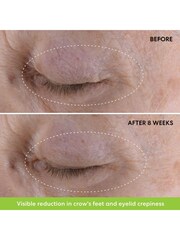 bareMinerals Ageless Retinol Eye Cream 15ml - Image 2 of 5