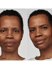 Clinique Even Better Clinical Serum Foundation SPF20 - Image 3 of 5