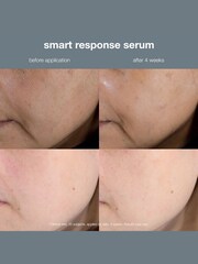 dermalogica Smart Response Serum 30ml - Image 5 of 5
