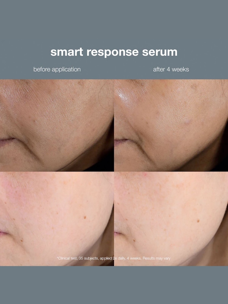 dermalogica Smart Response Serum 30ml - Image 5 of 5