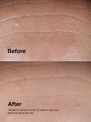 Clinique Smart Clinical Repair™ Wrinkle Correcting Serum 100ml - Image 3 of 5