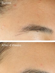 Murad Clarifying Oil Free Water Gel 48ml - Image 2 of 5