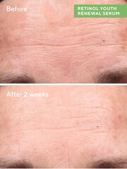 Murad Retinol Youth Renewal Serum 30ml - Image 3 of 5