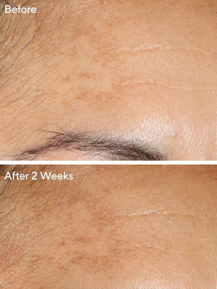 Murad Vita-C Glycolic Brightening Serum 30ml - Image 2 of 5