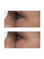 Perricone MD Cold Plasma Plus+ Eye (Advanced Eye Cream) 15ml - Image 5 of 5