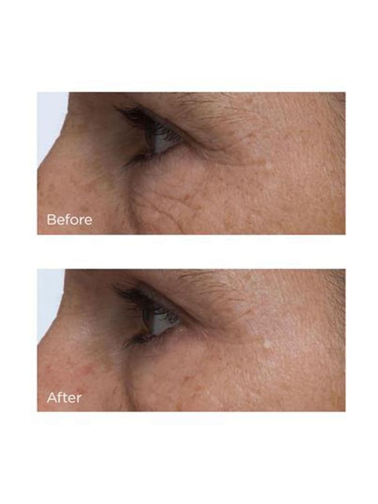 Perricone MD Cold Plasma Plus+ Eye (Advanced Eye Cream) 15ml - Image 5 of 5