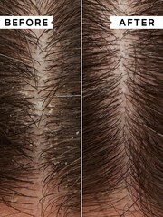 Philip Kingsley Flaky/Itchy Scalp Anti-Dandruff Conditioner 1000ml - Image 5 of 5