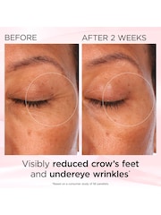 Elizabeth Arden Retinol + HPR Ceramide Rapid Skin Renewing Eye Cream - Image 13 of 16