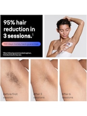 Braun Smart IPL Skin iexpert, At Home Hair Removal, With Free App, 4 Smart Heads, PL7441 - Image 5 of 10