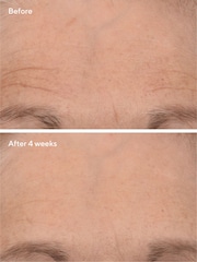 Murad Retinal ReSculpt Overnight Treatment - Image 4 of 6