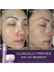 Lancôme Renergie Triple Serum Retinol Routine Set (Worth £160) - Image 3 of 7