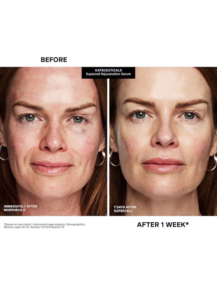 Kate Somerville SuperCell Rejuvenation Serum 1oz / 30ml - Image 9 of 9 Kate Somerville SuperCell Rejuvenation Serum 1oz / 30ml - Image 9 of 9