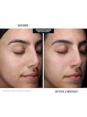 Kate Somerville Pore-fect Skin Edit Travel Kit : ExfoliKate, EradiKate, & Goat Milk Cleanser Gift Set - Image 4 of 8