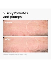 The Ordinary The Sensitive Skin Collection with Hyaluronic Acid and Ceramides - Image 4 of 8
