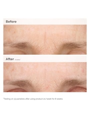The Ordinary Hydrating  Resurfacing Serum and Retinal Night Duo - Image 5 of 9