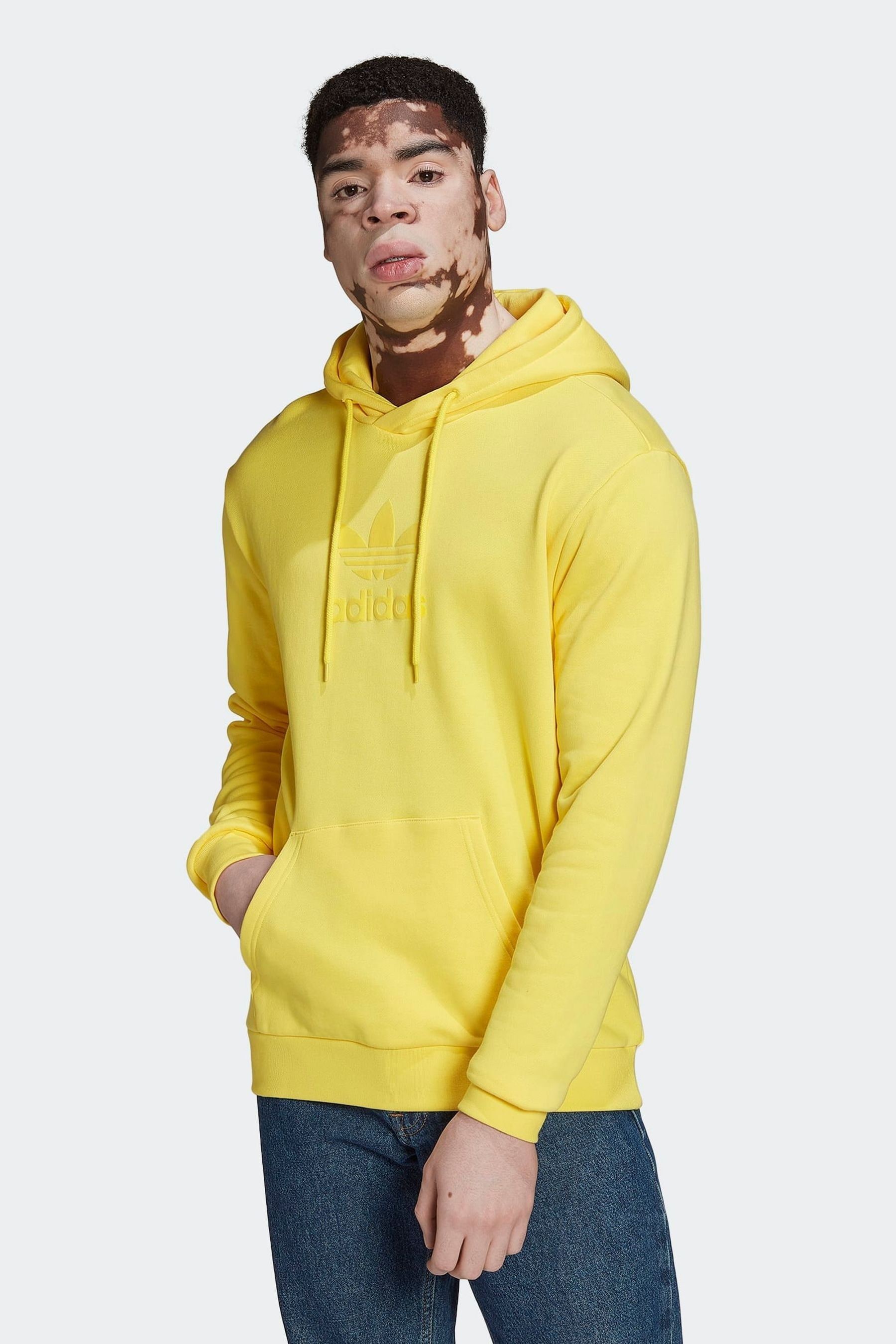 Adidas trefoil hoodie yellow store