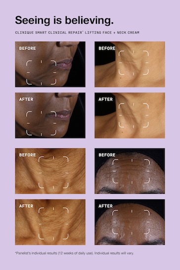 Clinique Smart Clinical Repair Lifting Face & Neck Cream 50ml
